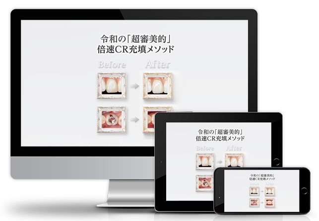令和の「超審美的」倍速CR充填メソッド│医療情報研究所DVD