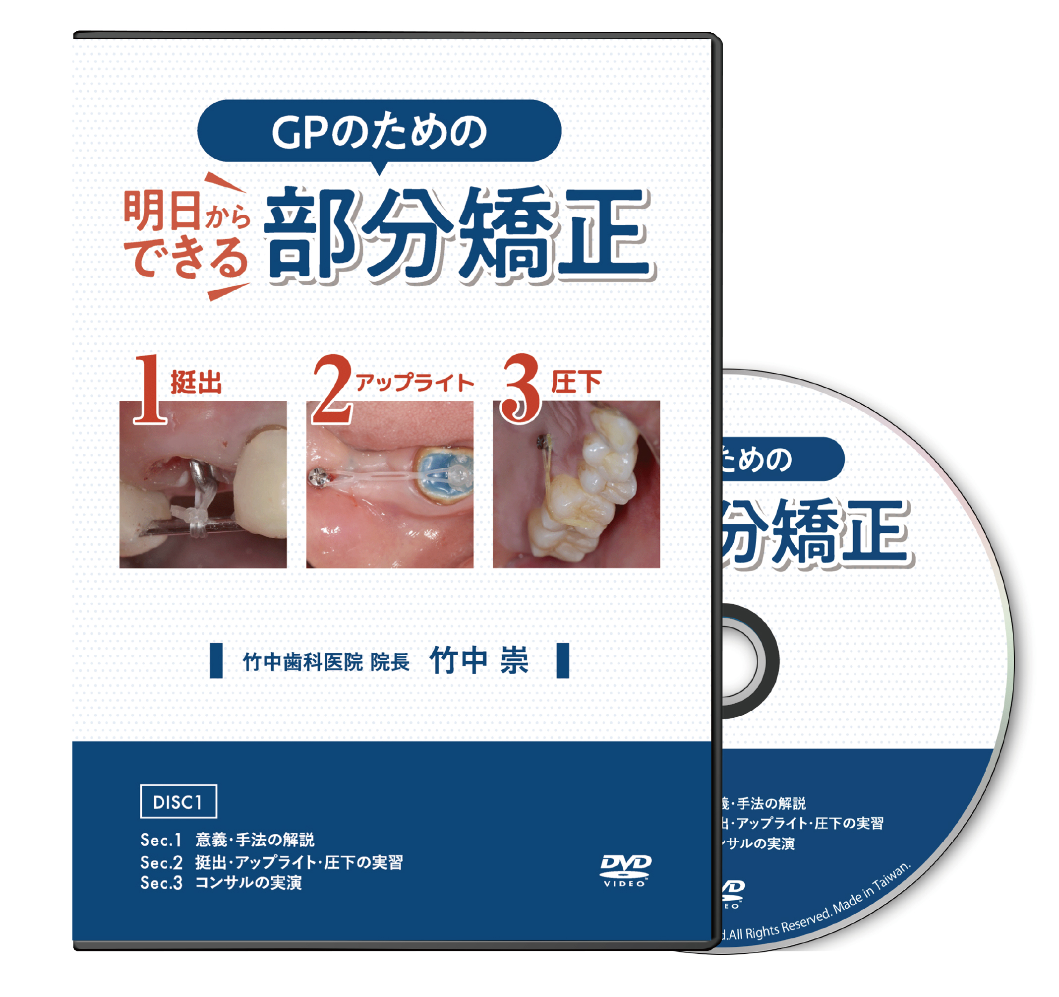 GPのための明日からできる部分矯正│医療情報研究所DVD
